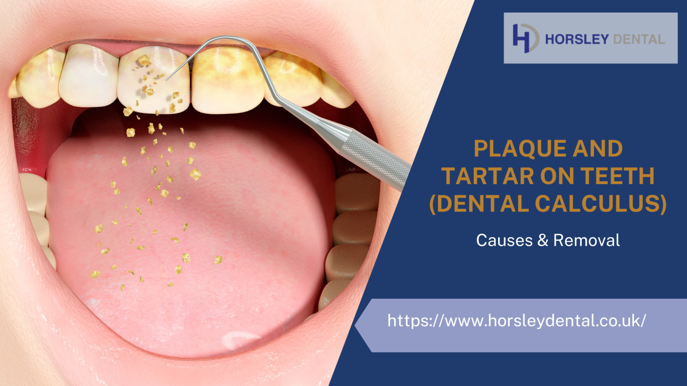 Plaque And Tartar On Teeth (Dental Calculus): Causes & Removal